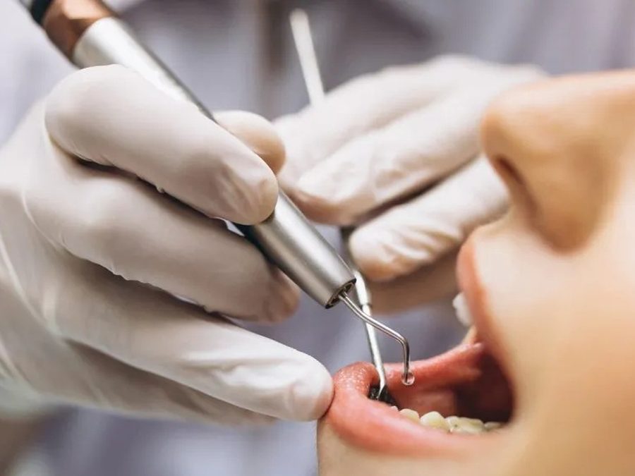 Dentista haciendo una limpieza dental